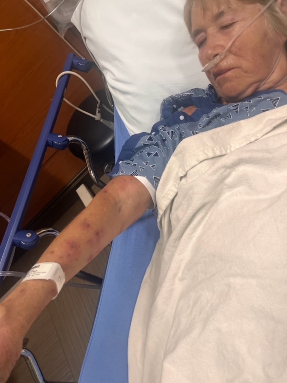 Montana Woman Survives Africanized Bee Attack on Arizona Golf Course